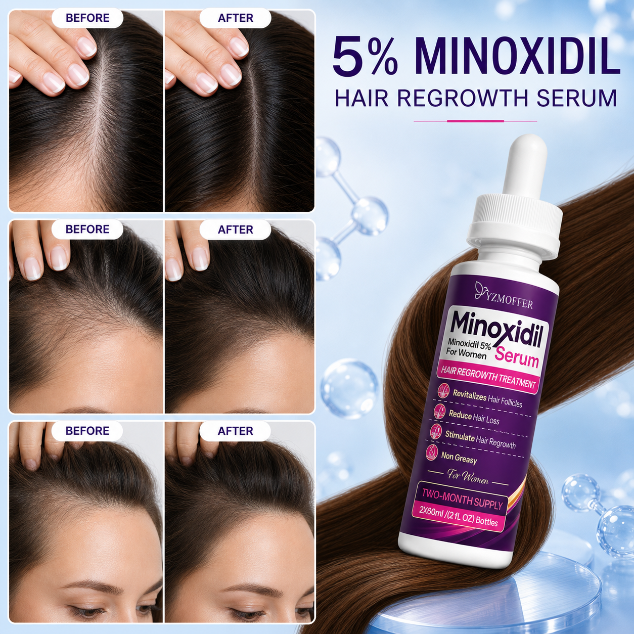 Minoxidil 5% Hair Regrowth Treatment for Women, Topical Serum Drops for Thinning Hair, Revitalizes Hair Follicles, Reduces Hair Loss, Non-Greasy Liquid Formula, 2-Month Supply - Image 3
