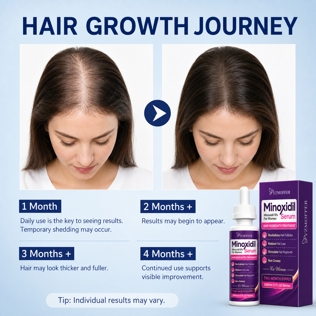Minoxidil 5% Hair Regrowth Treatment for Women, Topical Serum Drops for Thinning Hair, Revitalizes Hair Follicles, Reduces Hair Loss, Non-Greasy Liquid Formula, 2-Month Supply - Image 4